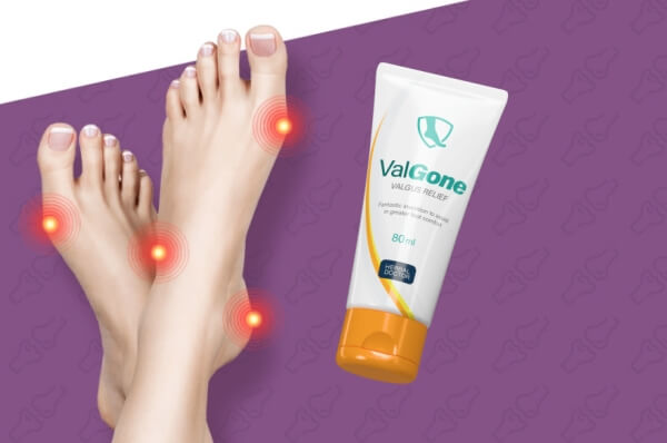 Valgone Creme Portugal - preço onde comprar Opiniões